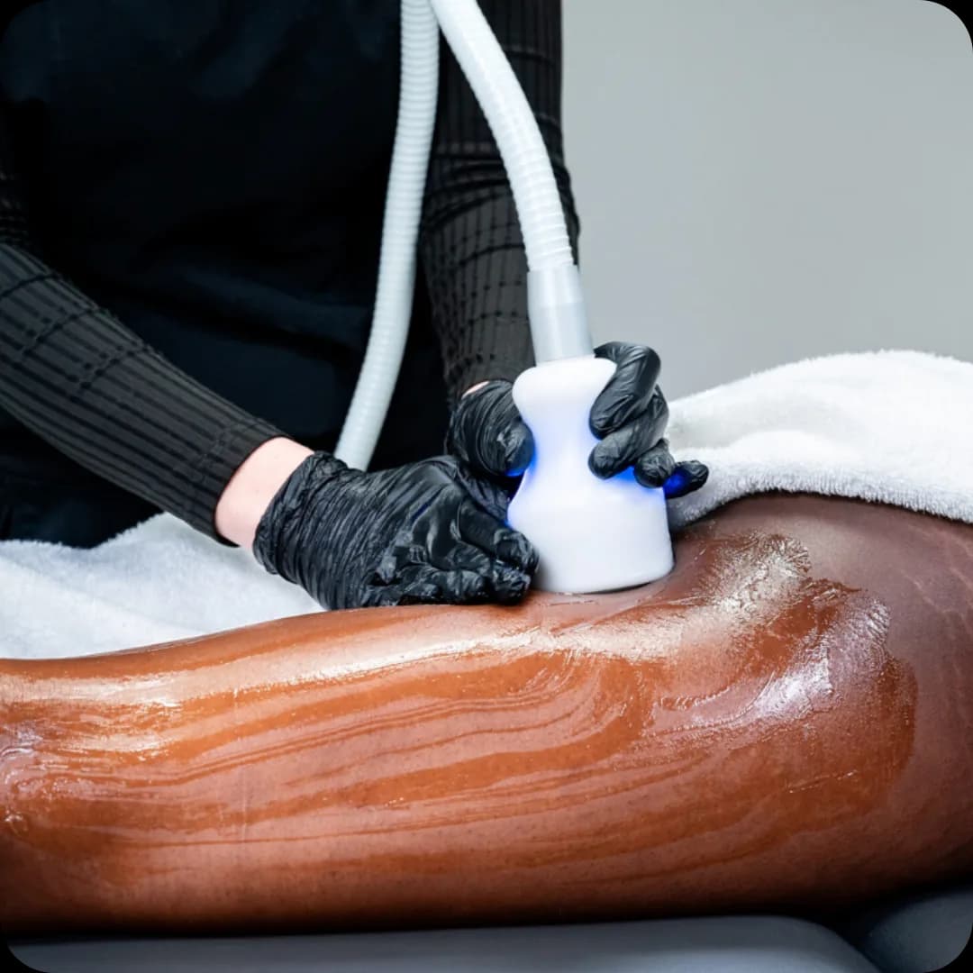 RINOVA Longevity body sculpting treatment room with warm lighting and luxury finishes